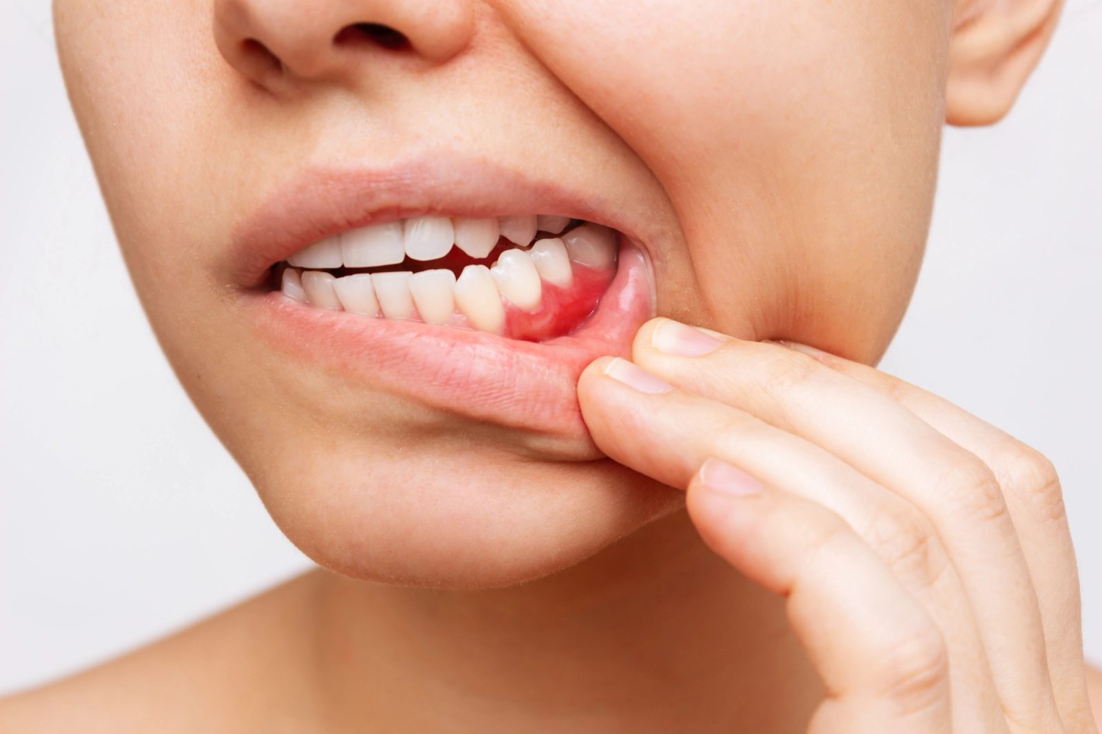 A woman holds her cheek because of a toothache